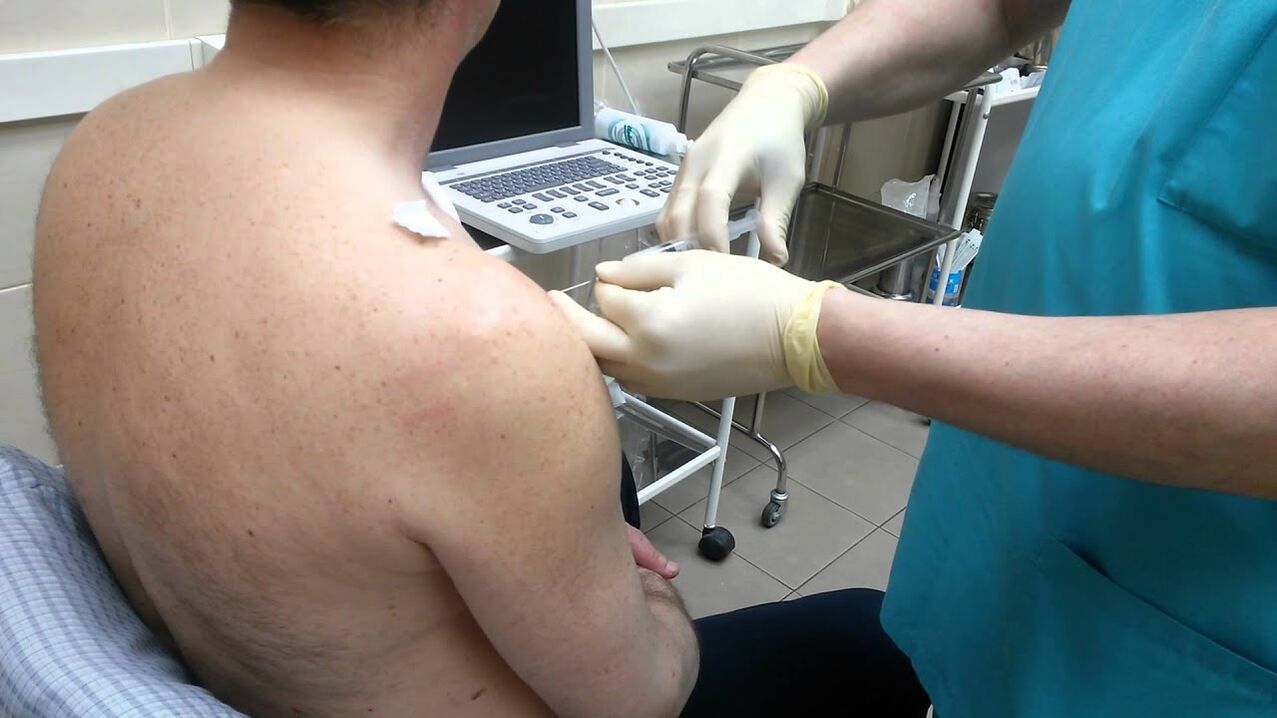 injection in the shoulder with arthrosis