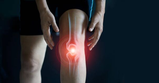 Arthrosis of the knee joint